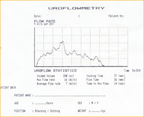 Uroflowmetry Machine Urinary Flow Meter Uroflowmetry Equipment Manufacturer Nidhi Meditech Systems